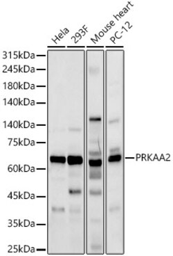 ABclonal Technology&nbsp;AMPKα2 Rabbit pAb