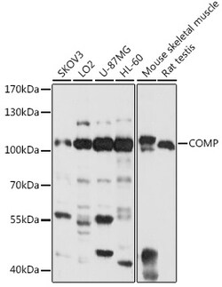 ABclonal Technology&nbsp;COMP Rabbit pAb
