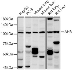 ABclonal Technology&nbsp;AHR Rabbit pAb