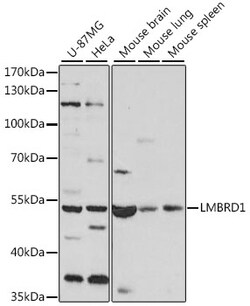 ABclonal Technology&nbsp;LMBRD1 Rabbit pAb