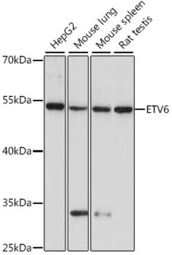 ABclonal Technology&nbsp;ETV6 Rabbit pAb