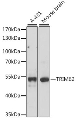 ABclonal Technology&nbsp;TRIM62 Rabbit pAb