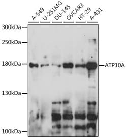ABclonal Technology&nbsp;ATP10A Rabbit pAb