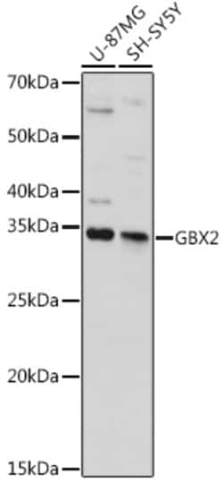 ABclonal Technology&nbsp;GBX2 Rabbit pAb