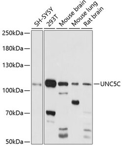 ABclonal Technology&nbsp;UNC5C Rabbit pAb