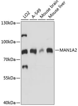 ABclonal Technology&nbsp;MAN1A2 Rabbit pAb