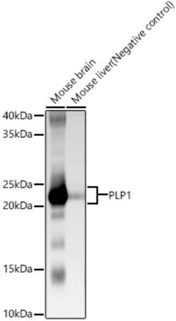 ABclonal Technology&nbsp;PLP1 Rabbit pAb