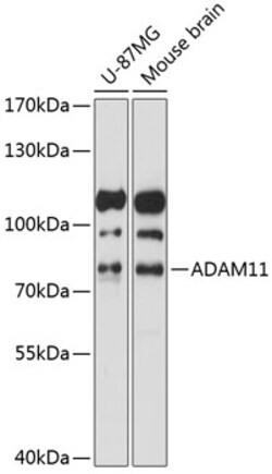 ABclonal Technology&nbsp;ADAM11 Rabbit pAb