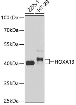 ABclonal Technology&nbsp;HOXA13 Rabbit pAb