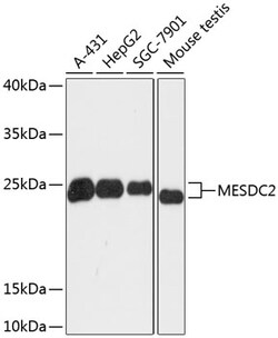 ABclonal Technology&nbsp;MESDC2 Rabbit pAb