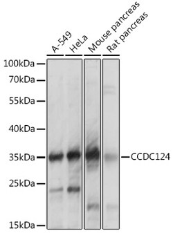 ABclonal Technology&nbsp;CCDC124 Rabbit pAb