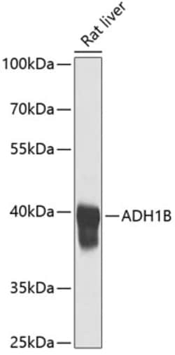 ABclonal Technology&nbsp;ADH1B Rabbit pAb