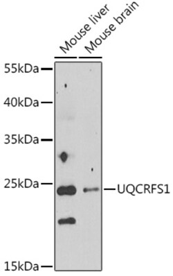 ABclonal Technology&nbsp;UQCRFS1 Rabbit pAb