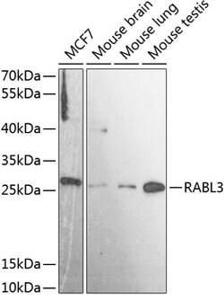 ABclonal Technology&nbsp;RABL3 Rabbit pAb