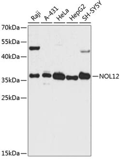 ABclonal Technology&nbsp;NOL12 Rabbit pAb