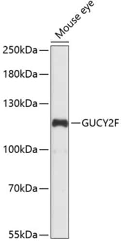 ABclonal Technology&nbsp;GUCY2F Rabbit pAb