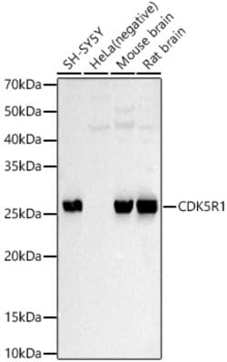ABclonal Technology&nbsp;CDK5R1 Rabbit pAb