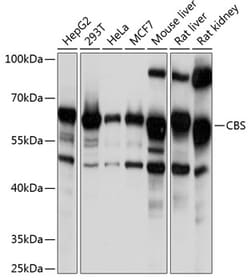 ABclonal Technology&nbsp;CBS Rabbit pAb