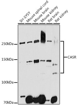 ABclonal Technology&nbsp;CASR Rabbit pAb