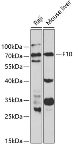 ABclonal Technology&nbsp;F10 Rabbit pAb