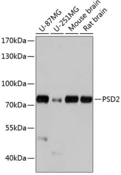 ABclonal Technology&nbsp;PSD2 Rabbit pAb