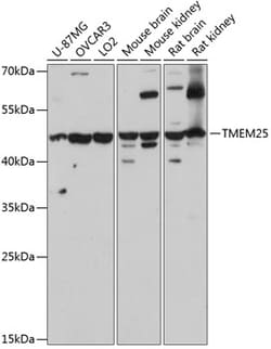 ABclonal Technology&nbsp;TMEM25 Rabbit pAb