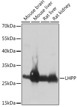 ABclonal Technology&nbsp;LHPP Rabbit pAb