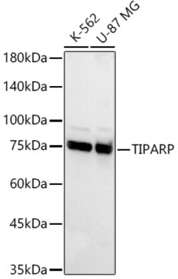 ABclonal Technology&nbsp;TIPARP Rabbit pAb