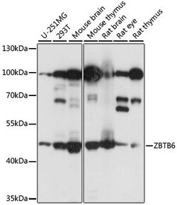 ABclonal Technology&nbsp;ZBTB6 Rabbit pAb