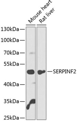 ABclonal Technology&nbsp;SERPINF2 Rabbit pAb