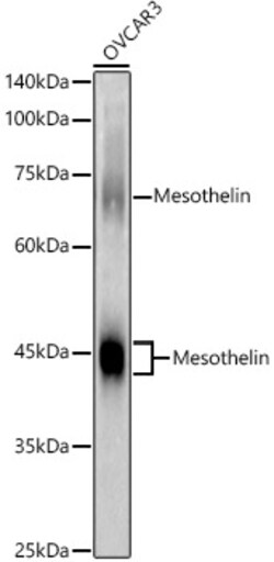 ABclonal Technology&nbsp;Mesothelin Rabbit pAb