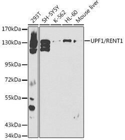 ABclonal Technology&nbsp;UPF1/RENT1 Rabbit pAb