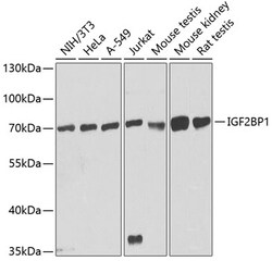ABclonal Technology&nbsp;IGF2BP1/IMP1 Rabbit pAb