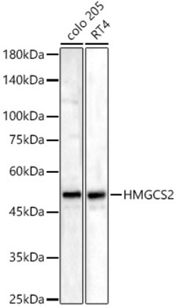 ABclonal Technology&nbsp;HMGCS2 Rabbit pAb