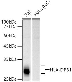 ABclonal Technology&nbsp;HLA-DPB1 Rabbit pAb