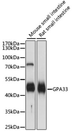 ABclonal Technology&nbsp;GPA33 Rabbit pAb
