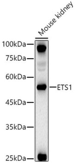 ABclonal Technology&nbsp;ETS1 Rabbit pAb