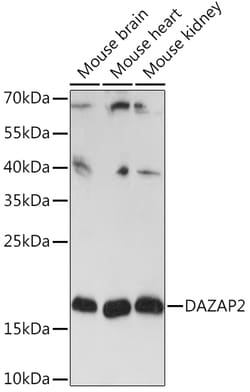 ABclonal Technology&nbsp;DAZAP2 Rabbit pAb