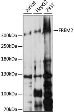 ABclonal Technology&nbsp;FREM2 Rabbit pAb
