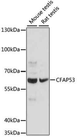 ABclonal Technology&nbsp;CFAP53 Rabbit pAb