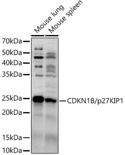 ABclonal Technology&nbsp;CDKN1B/p27KIP1 Rabbit pAb