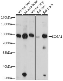 ABclonal Technology&nbsp;SOGA1 Rabbit pAb