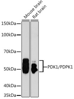 ABclonal Technology&nbsp;[KO Validated] PDK1/PDPK1 Rabbit pAb