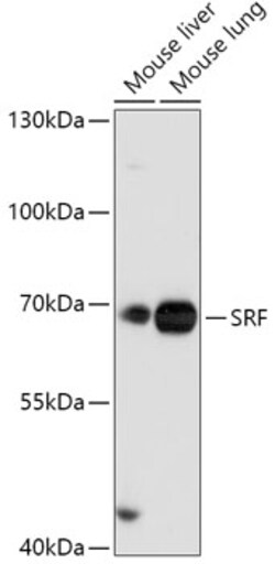 ABclonal Technology&nbsp;SRF Rabbit pAb