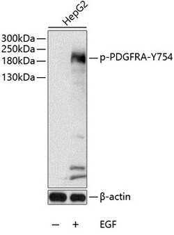 ABclonal Technology&nbsp;Phospho-PDGFR alpha-Y754 Rabbit pAb