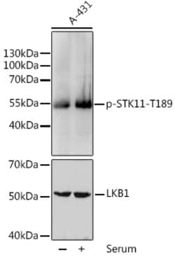 ABclonal Technology&nbsp;Phospho-STK11-T189 Rabbit pAb