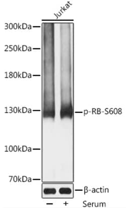 ABclonal Technology&nbsp;Phospho-RB-S608 Rabbit pAb
