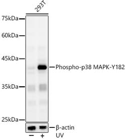 ABclonal Technology&nbsp;Phospho-p38 MAPK-Y182 Rabbit pAb