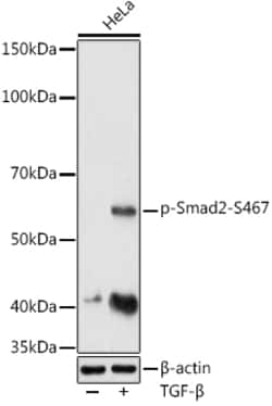 ABclonal Technology&nbsp;Phospho-Smad2-S467 Rabbit pAb
