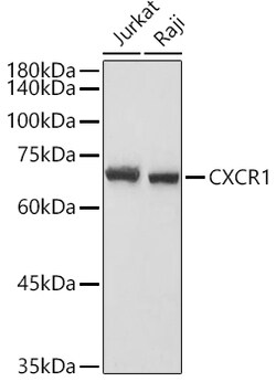 ABclonal Technology&nbsp;CXCR1 Rabbit pAb